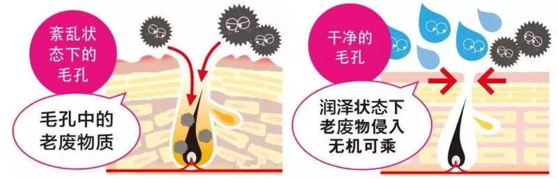红肿，流脓的万年毒痘一喷全消失？岛国新晋痘肌终结者！彻底祛痘不反复！