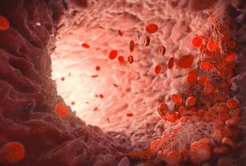 清肺神器,清肺散结神器