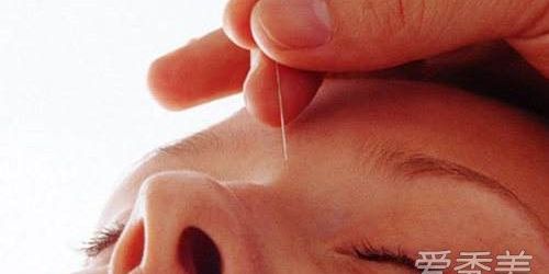 针灸瘦脸脸部会紧实吗,瘦脸针灸视频全过程