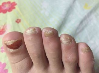 鍚嶅尰涓撴爮绉嬪鍏荤敓,鍚嶅尰涓撴爮杩滅鐥涢