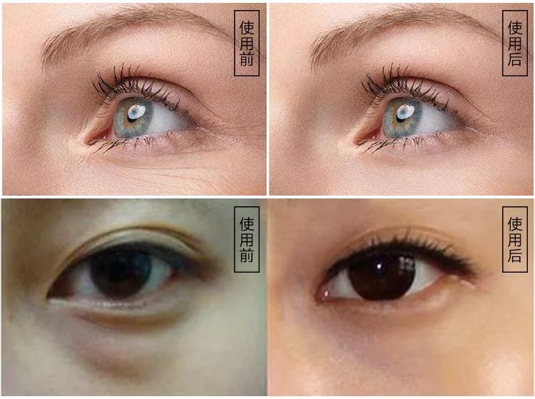 45岁没皱纹看起来像25岁，是如何做到的？