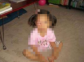 一粒小小的“针眼”，4岁女童差点丧命！就因为奶奶这个举动……