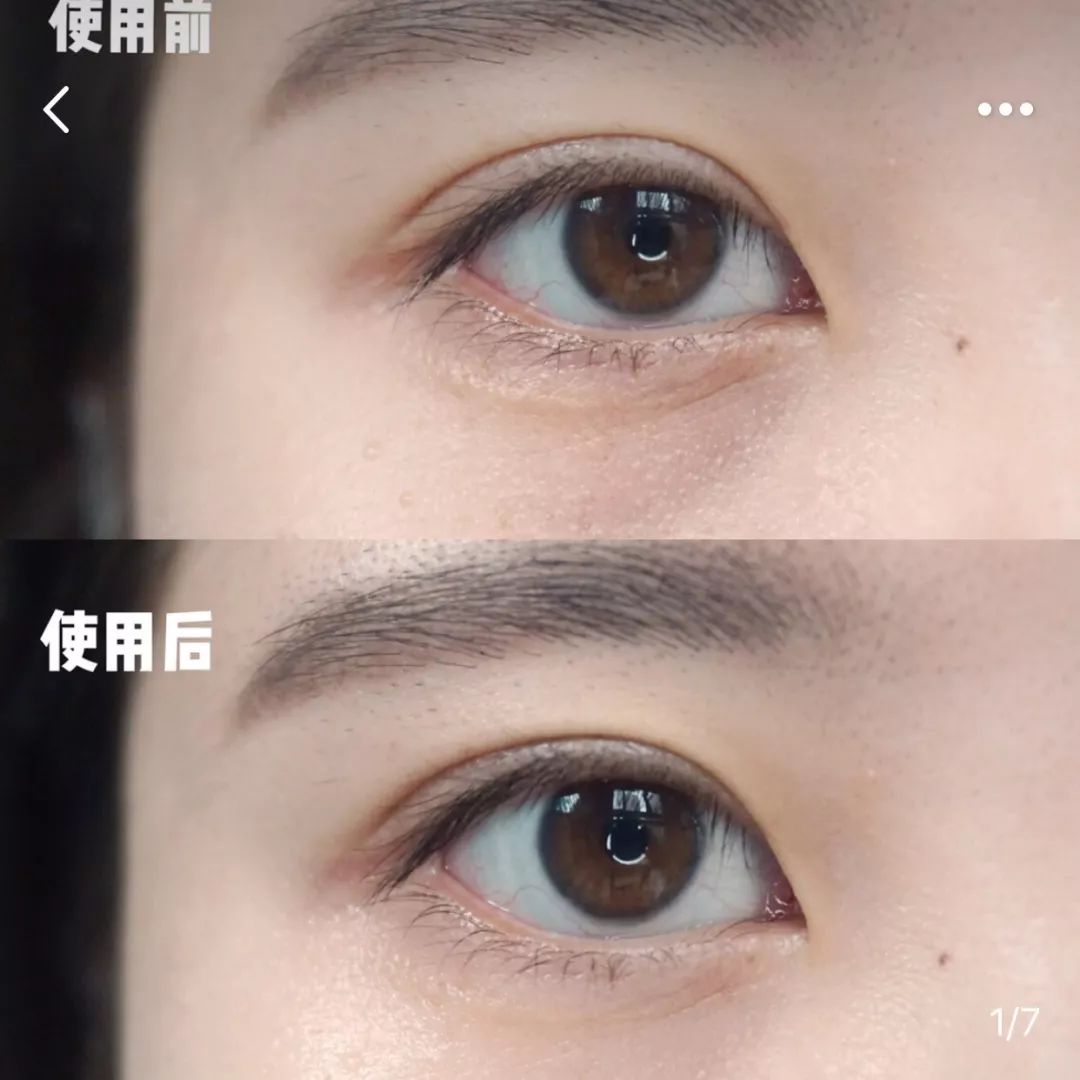 能去脂肪粒的眼霜,又能去纹又能去黑眼圈的眼霜