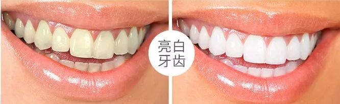 牙黄口臭用什么牙膏有效果一点,烟黄牙洗牙能洗白吗