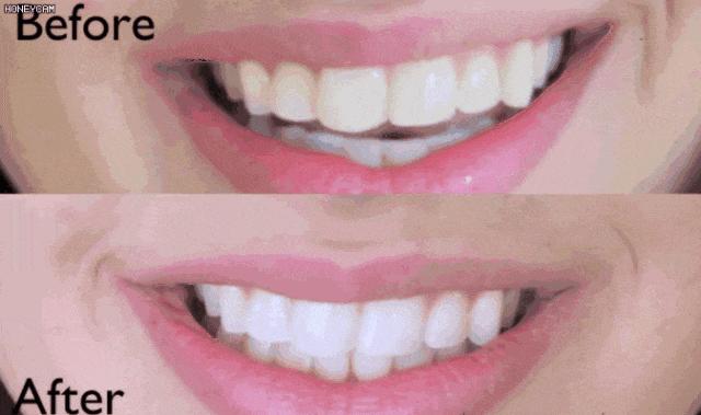 各路明星网红都在推的牙膏,震惊网红都在用的牙膏