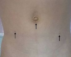 小腹部下面大腿根部鼓起,大腿根部鼓起一个包是怎么啦