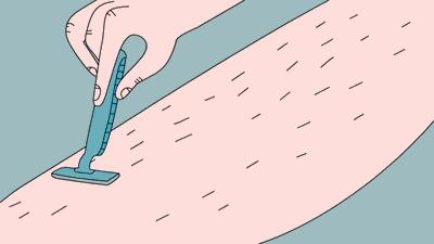 成都医美月▏现在不脱毛，夏季猕猴桃，你不脱毛？100%尴尬