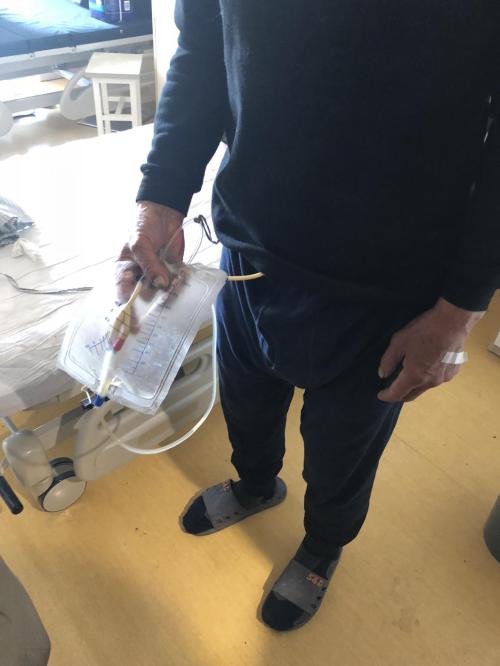 老人“绑”着尿袋生活4年多眼瞅入冬了，这是告别尿袋最好的时机