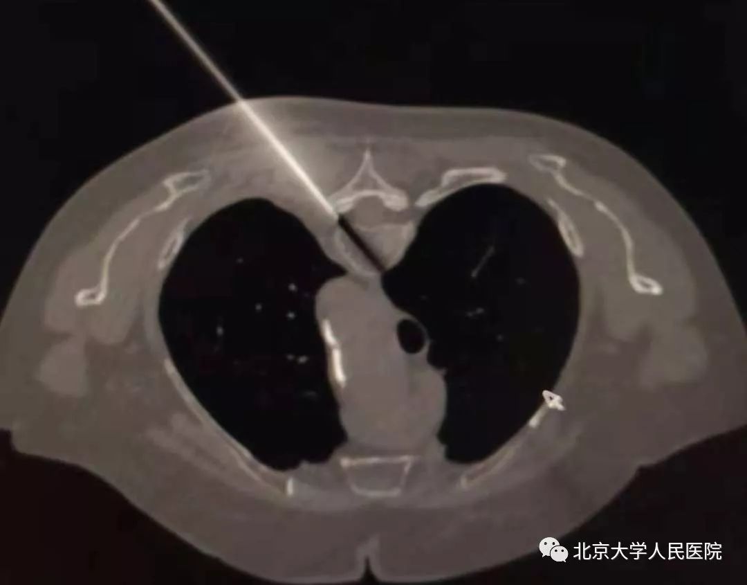 科普胸痛千万不要大意,医生科普疼痛科