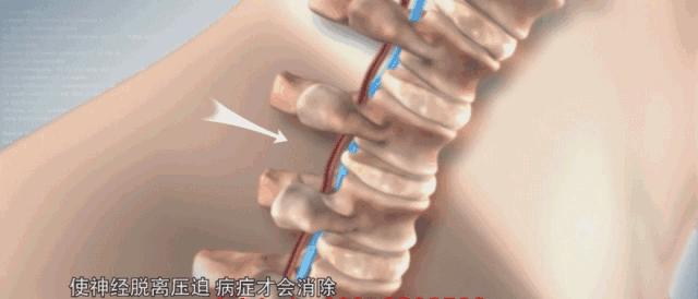 颈肩腰疼用什么热敷,颈肩腰痛小偏方