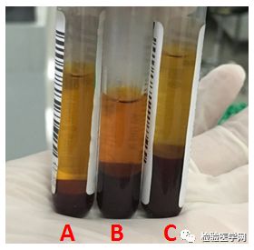 血钾低挂什么科查明原因,为什么血钾低要住院检查