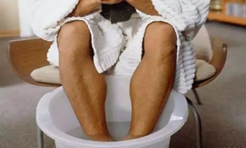 预防腿部静脉曲张最好的方法,静脉曲张的六个误区