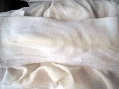 如何清洗衣领上的顽固黄渍,娃的衣领污渍怎么才能洗干净