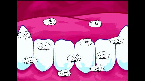 用了美白牙膏白了一颗牙,用了美白牙膏后还用清洁吗