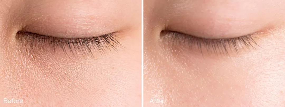 能去脂肪粒的眼霜,又能去纹又能去黑眼圈的眼霜