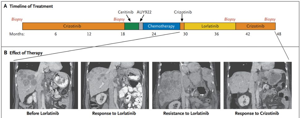 为什么靶向药不能治愈肺癌,肺癌靶向药是不是只针对晚期癌症