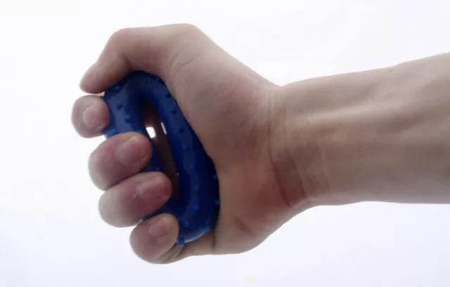 透析病人内瘘胀痛是怎么回事,透析病人内瘘血栓形成如何处理