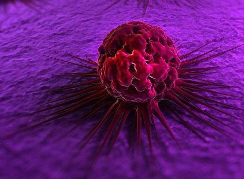 甲母痣癌变率,肉痣癌变几率