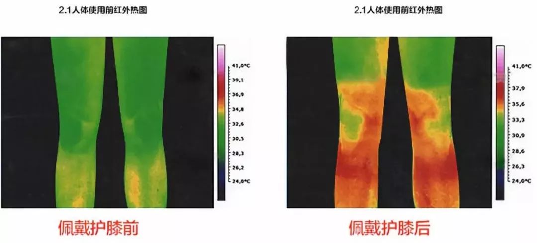 治疗老寒腿的电疗护膝,老寒腿护膝黑科技产品