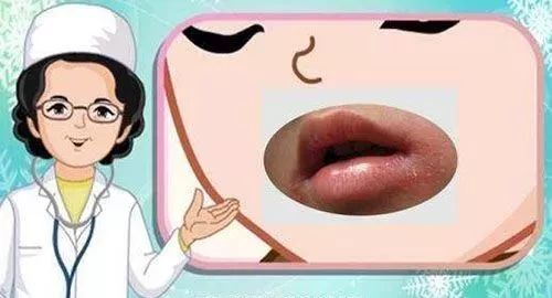 药店里几毛钱的药膏，竟能缓解治疗12种常见病痛！不看亏大啦~