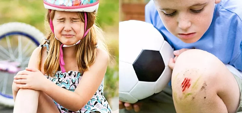 斑疤痘敏妊娠纹,伤痕印如何能快速消除