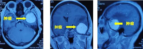 因祸得福第二集,因祸得福上下集免费