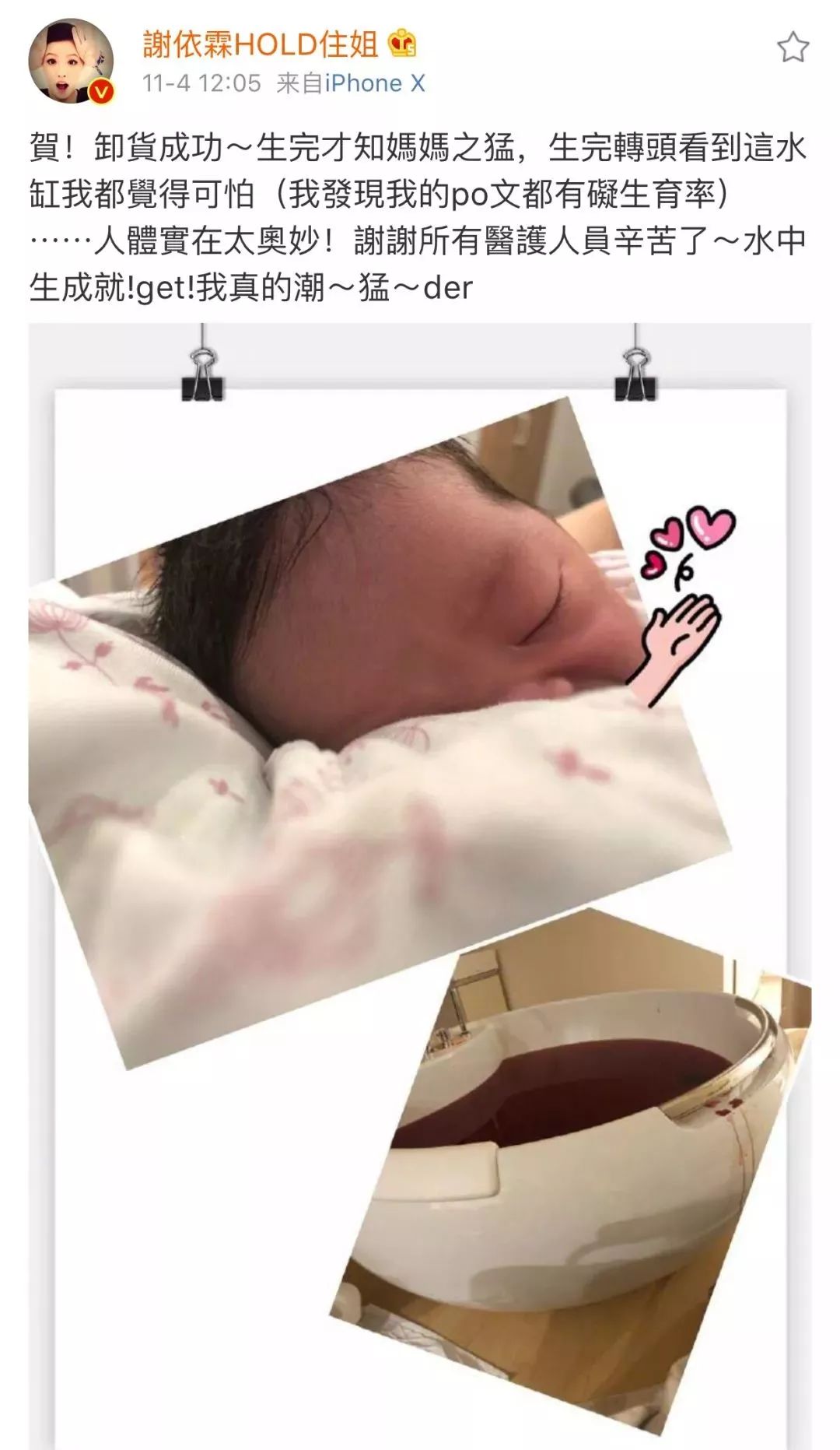 谢依霖水中分娩后判若两人,谢依霖水中产子后遗症