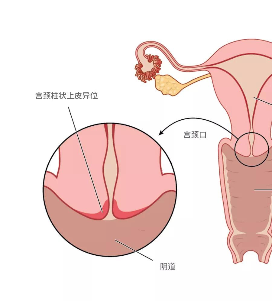 专骗女人的十大骗局,专骗女人的新型骗局