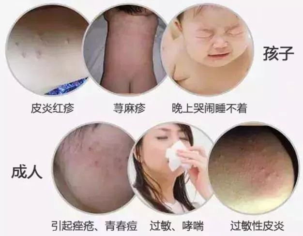 最全最有效去除家里的螨虫方法,家里螨虫怎样能彻底清除