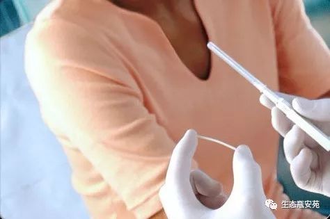 不同人群避孕措施,人工流产后几个月避孕