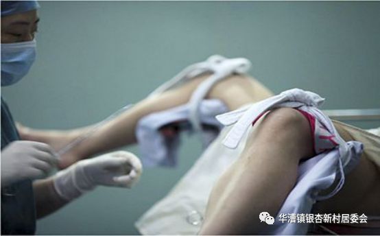 不同人流产,人工流产后几个月避孕