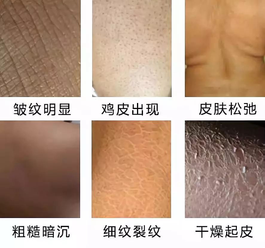 卖疯了！澳洲平价绵羊油，秋冬补水保湿首选，一罐用全身，英国女王都打call