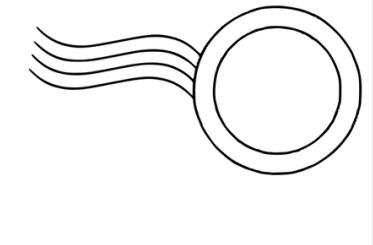 骨水泥治疗老年压缩性腰椎骨折,骨水泥治疗骨质疏松脊柱骨折