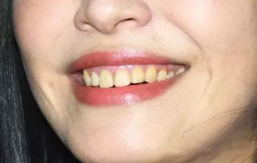 俄罗斯牙膏美白去口臭牙黄,去牙垢黄牙的牙膏测评