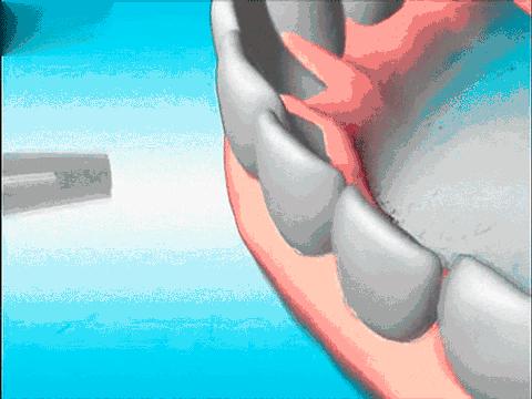 男子发现梅毒潜伏20年,男子身患梅毒