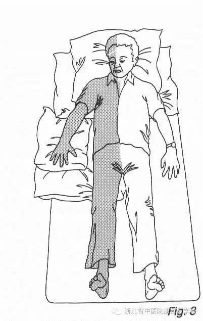 卒中康复中医治疗方法,卒中患者的康复流程