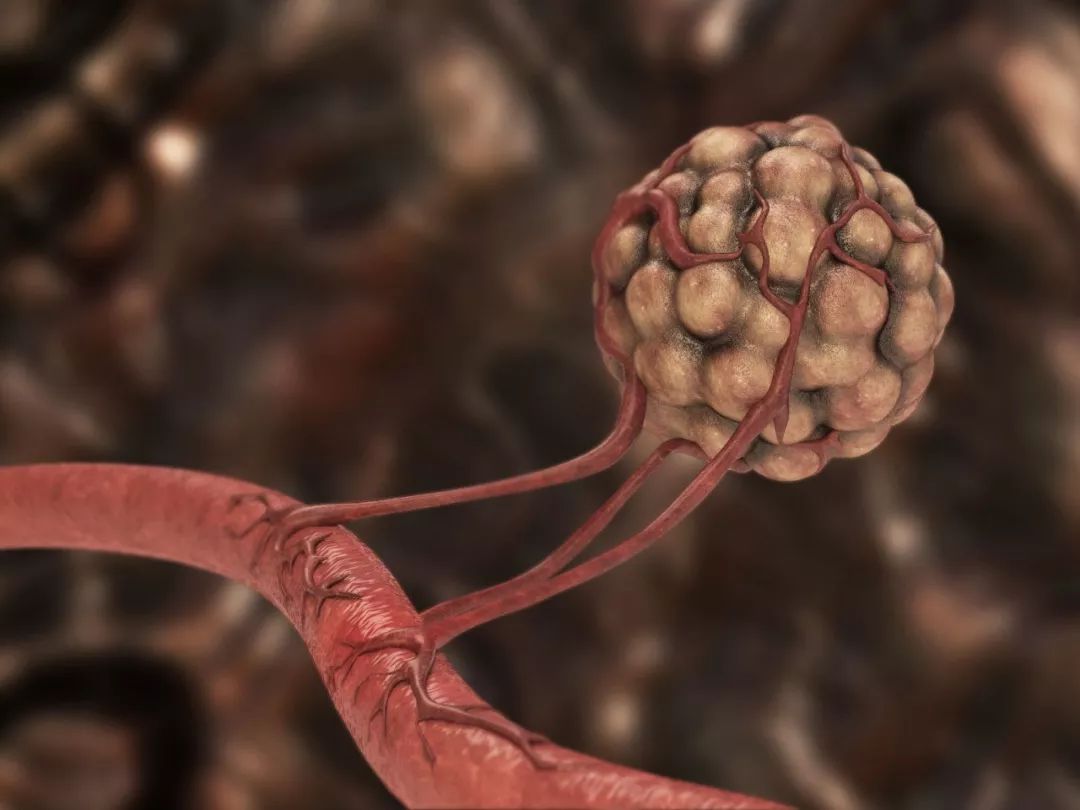 宝刀未老！全球首个饿死癌细胞的抗癌药，30年后成为免疫治疗的神助攻