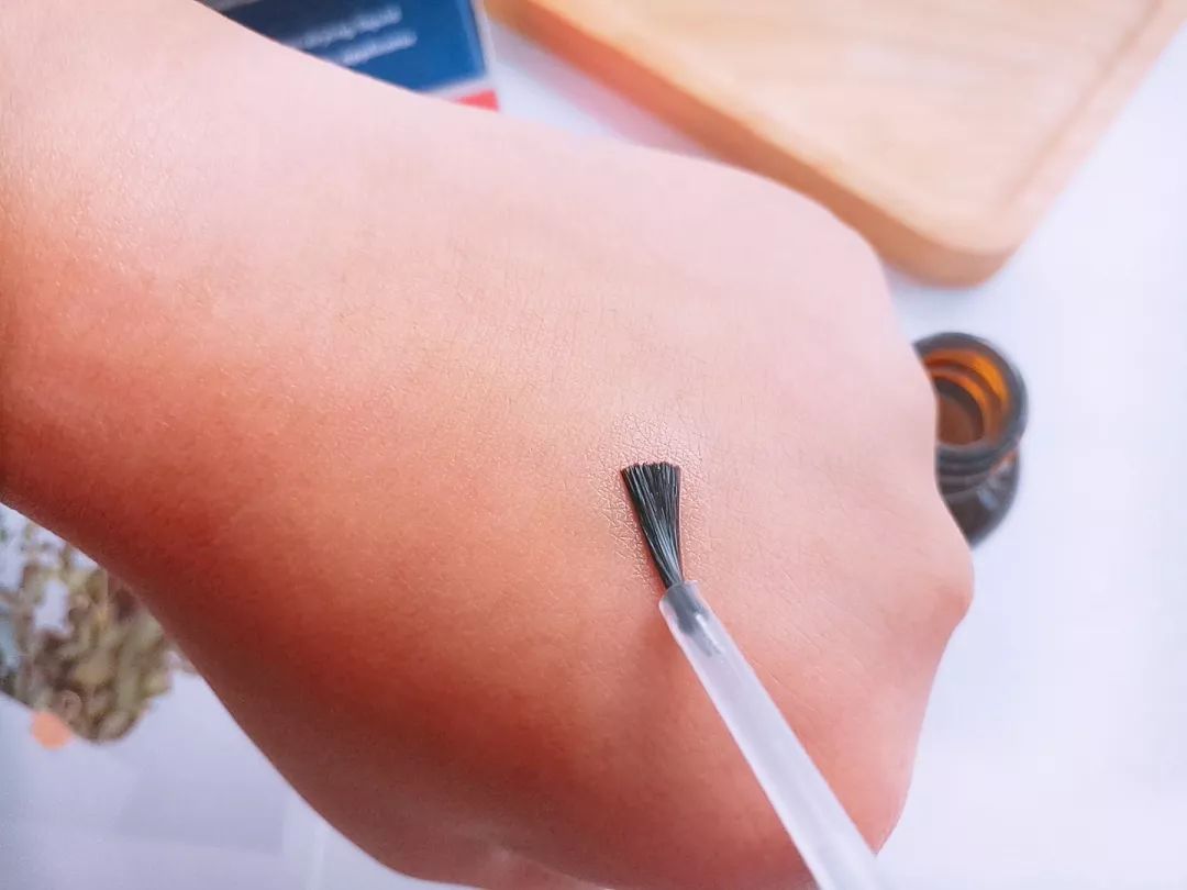 灰指甲的治愈之路你值得拥有,10年顽固灰指甲久治不愈