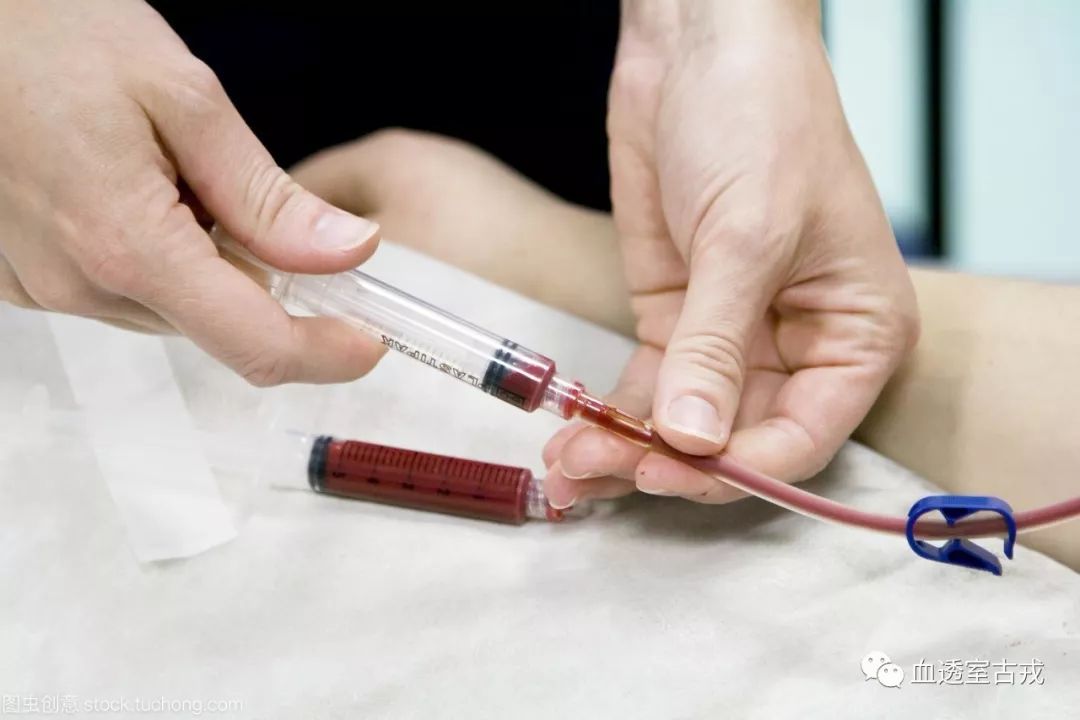 血透护士首次关注事项,血透护士要做些什么