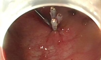 坐过山车排肾结石，吃人肉有助于减肥，2018搞笑诺贝尔奖了解一下？