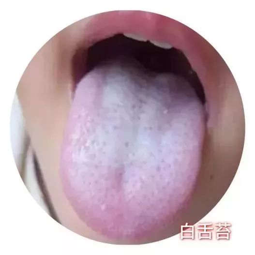 小朋友受寒感冒怎么办最快最有效,孩子刚感冒时怎么避免加重