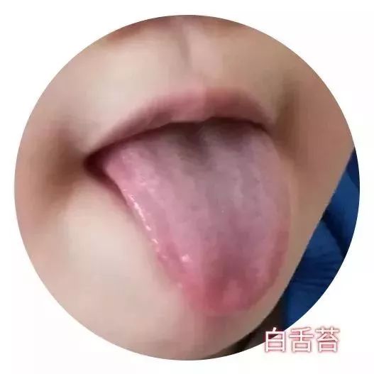 小朋友受寒感冒怎么办最快最有效,孩子刚感冒时怎么避免加重