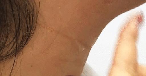 能去脂肪粒的眼霜,又能去纹又能去黑眼圈的眼霜