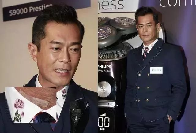 颈椎病猝死多少人,颈椎病死了多少人