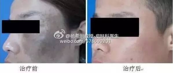 让你轻松告别色斑的困扰,告别暗沉淡化色斑