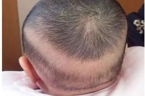 宝宝缺钙怎么补钙效果最好,宝宝缺钙怎么补钙效果好