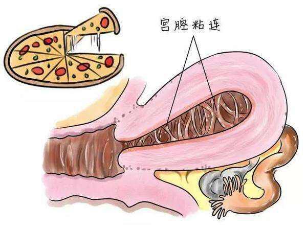 妇科月经推迟怎么治,调理妇科经期延迟