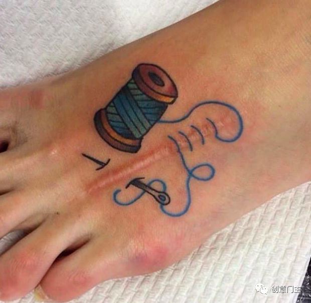 去除纹身疤痕最好的方法,疤痕纹身怎么去除