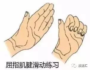 鼠标手康复科普文章,鼠标手的康复和治疗