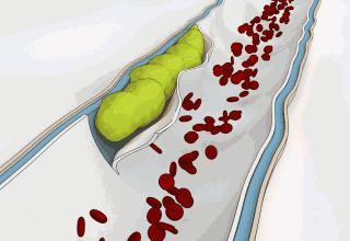 什么中药泡水喝对心血管有好处,三种中草药泡水治疗冠心病